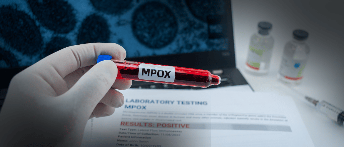 Mpox: Brasil chega a 140 casos confirmados em 2026 e São Paulo lidera registros