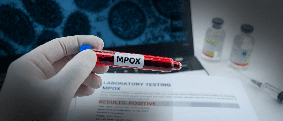 Mpox: Brasil chega a 140 casos confirmados em 2026 e São Paulo lidera registros